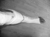 Spaltgips