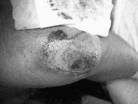Knie